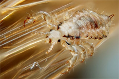 Head-Louse